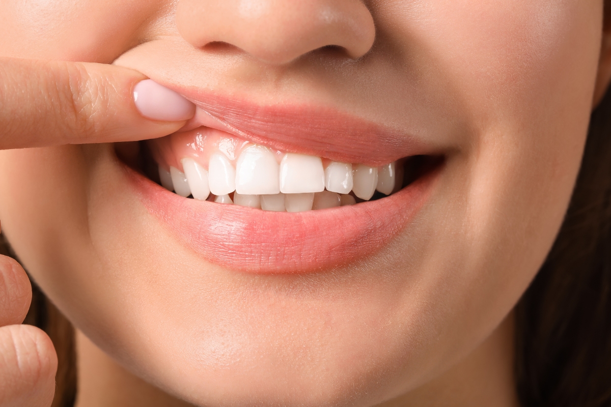 Gum Surgeries Periodontal Treatment in Anand
