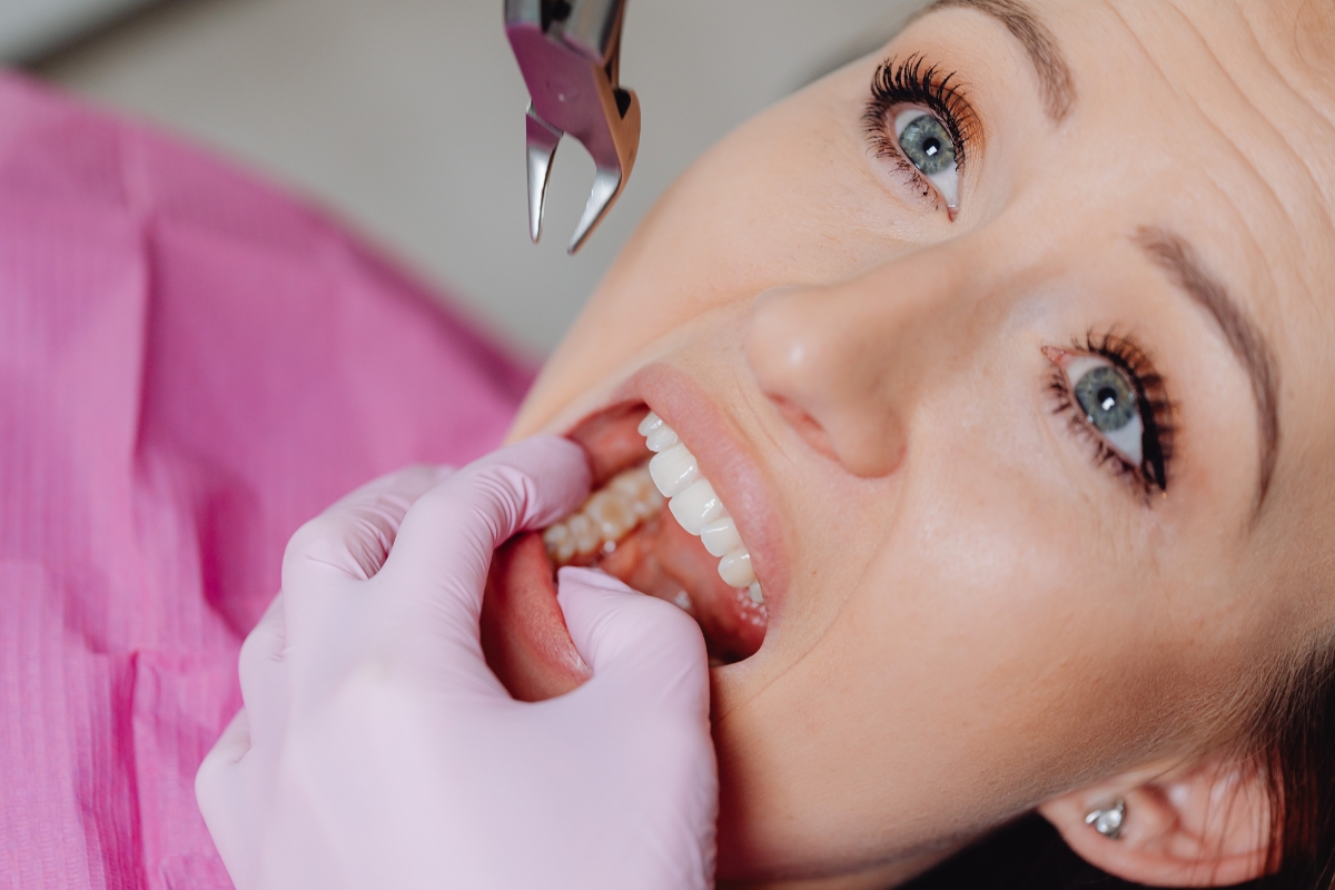 Wisdom Tooth Surgery Anand