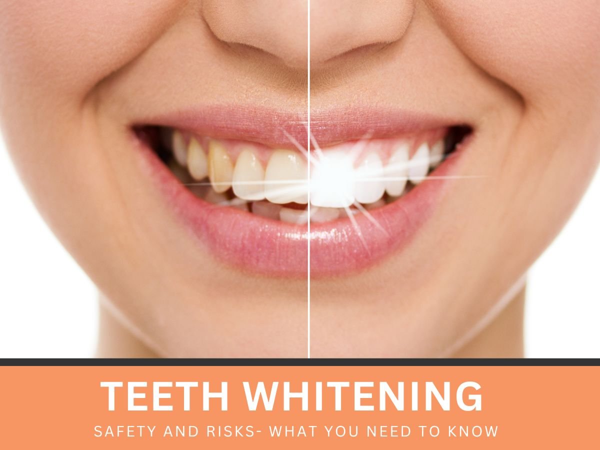 Teeth Whitening Safety and Risks: What You Need to Know
