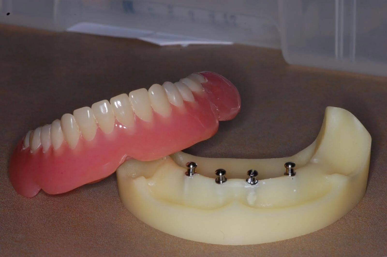 Dr_Gandhi_Dental_Clinic_Treatment_Image_Of_Teeth_Replacement_Foundatation